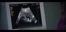 فیلم تکان دهنده از سقط جنین