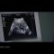 فیلم تکان دهنده__ عمل وحشیانه -سقط جنین- thumbnail
